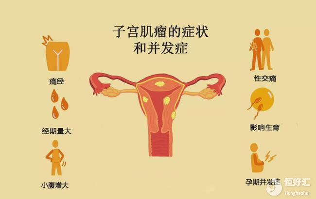 子宮肌瘤會影響懷孕并導致不孕嗎？