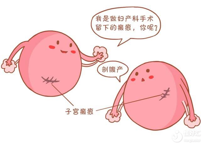 瘢痕子宮是什么？能做試管嬰兒嗎？